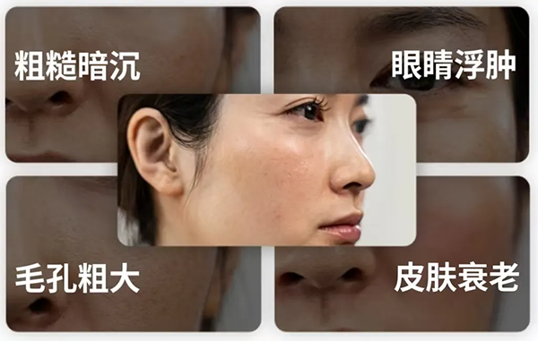 冰磯堂顏究站 | 熬夜后皮膚為何會(huì)變黃？